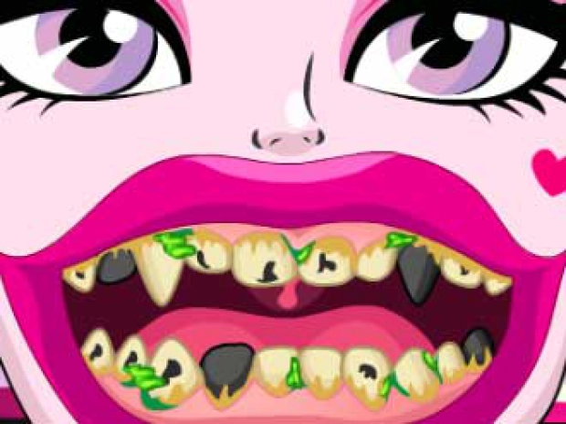 Game: Draculaura Bad Teeth